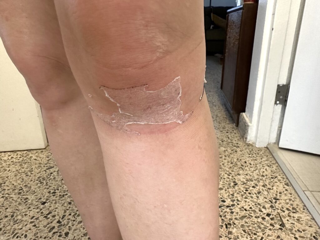 KT Tape Pro Ice adhesive